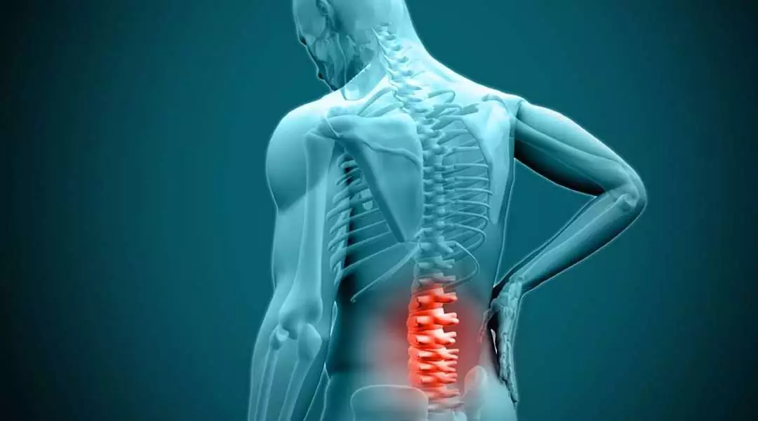 Herniated